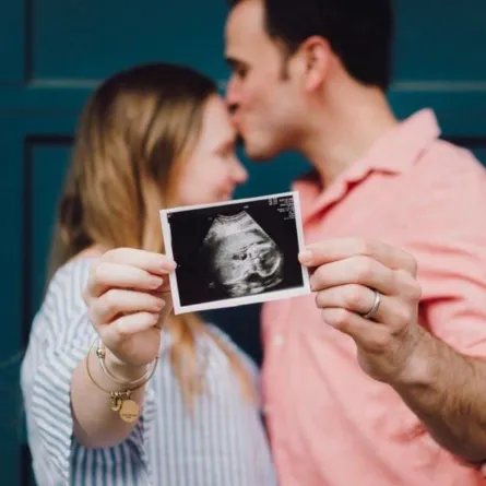صورة لزوجين يحصلان على صورة  للجنين القادم