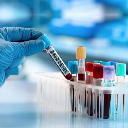 طرق علاج أنواع الأنيميا