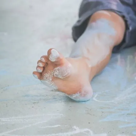 صورة لطفل أصيب بوقوعه على الأرض في مكان منزلق للترفيه والمرح