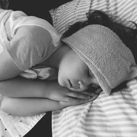 صورة لطفلة مصابة بالحمى