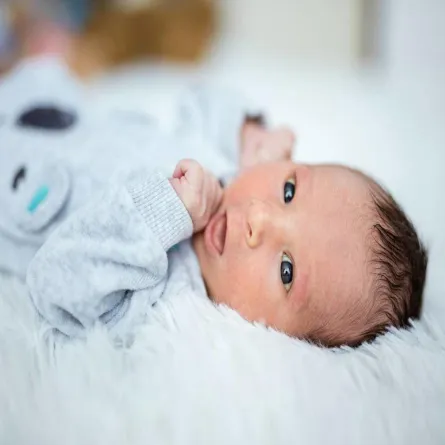 صورة لطفل رضيع يعاني من مشاكل في العين