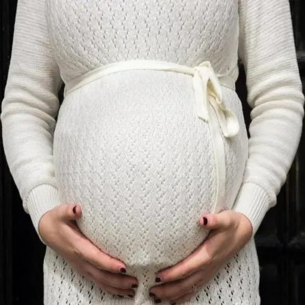 صورة لحامل تعاني من علامات التمدد