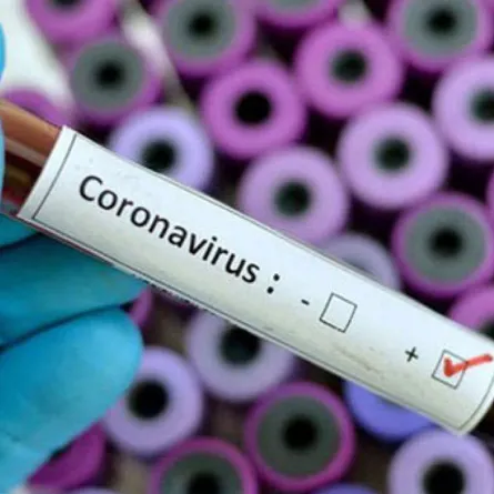 اختراع سعودي يكشف عن الإصابة بكورونا خلال 15 دقيقة