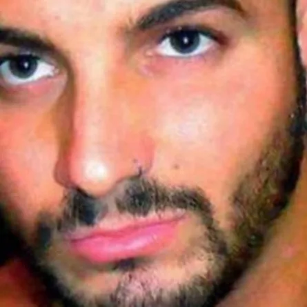 شاب يجري عمليات تجميل غريبة ليتحول إلى كائن فضائي