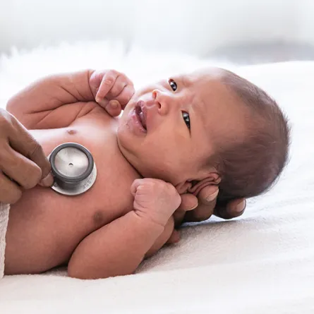 أعراض حموضة المعدة عند الأطفال الرضع