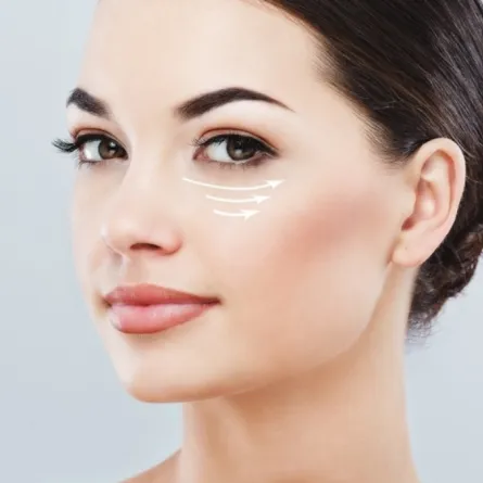 أفضل وصفة طبيعية للتخلص من الهالات السوداء نهائياً