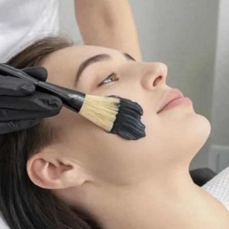 فوائد الليزر الكربوني للوجه