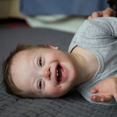 اليوم العالمي لمتلازمة داون.. كيف نتعامل معهم؟