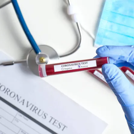 الصحة السعودية توضح الفرق بين فحصي pcr والأجسام المضادة