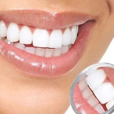 التهاب اللثة والعلاجات المتاحة برأي طبيبة