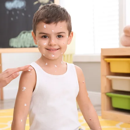 أسباب ظهور الدمامل عند الأطفال