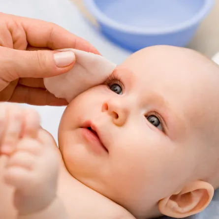 أعراض انسداد القناة الدمعية عند الأطفال 