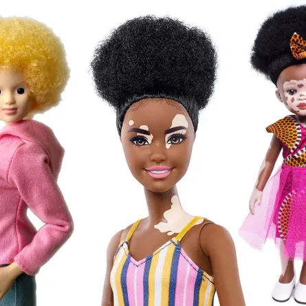 في اليوم الدولي للتوعية بالمهق... دمى للأطفال مصابة بالمرض