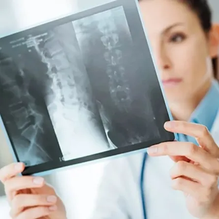 أسباب الإصابة بهشاشة العظام والعلاجات الطبيعية