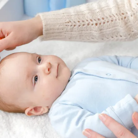 أسباب وعلاج قشرة رأس الرضيع