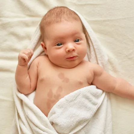 أسباب ظهور بقع بنية وحمراء على جلد الرضيع