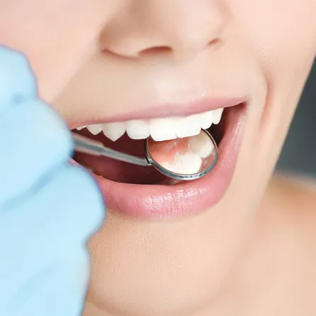 علامة في الأسنان ترصد مرض هشاشة العظام