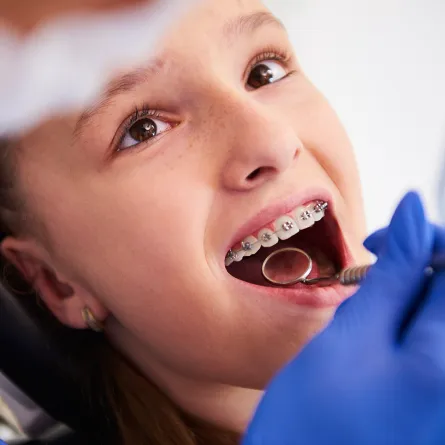 متى يحتاج طفلي إلى تقويم الأسنان؟ وما العمر المناسب؟