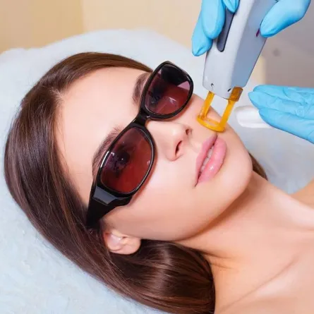 ليزر البشرة