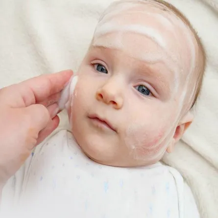 الطفح الحراري عند الأطفال: أنواعه وأعراضه وعلاجه والوقاية منه