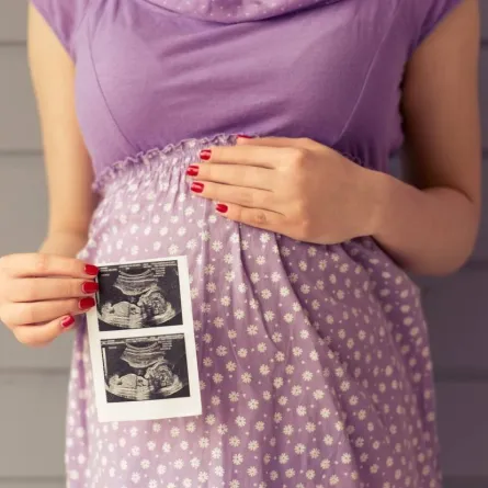 صورة لامرأة حامل