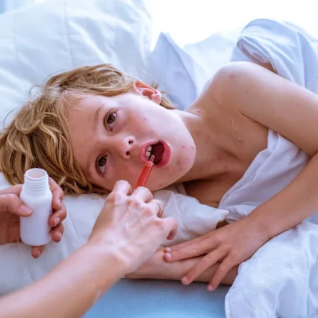 صورة لأم تعالج طفلها بخافض حرارة في المنزل من أعراض الهربس المزعجة