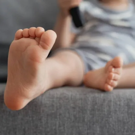 صورة لطفل يعاني من تقوس الساق بسبب نقص فيتامين د