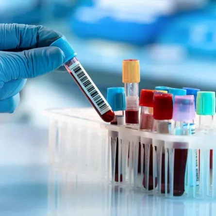 فيروس كورونا: فصيلة الدم تلعب دوراً في الإصابة