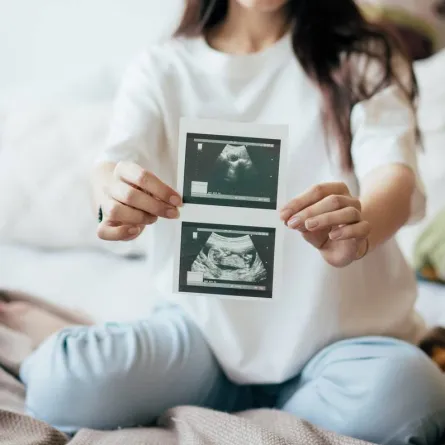صورة تكشف عن طريقة جلوس الجنين