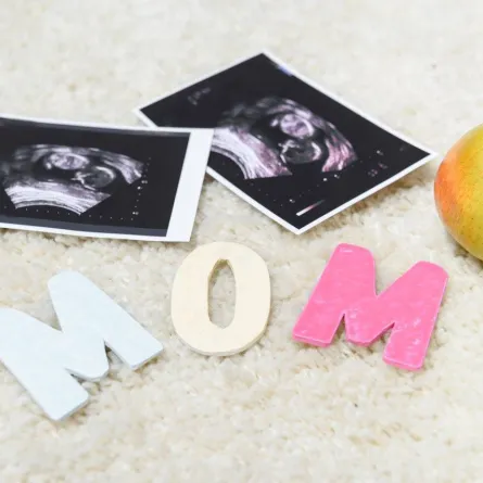 صورة لنوع الجنين