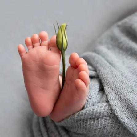 صورة تعبيرية عن غرز الولادة