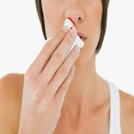 أسباب نزيف الأنف في الشتاء