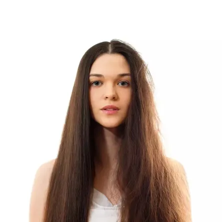 اعراض حرق الشعر