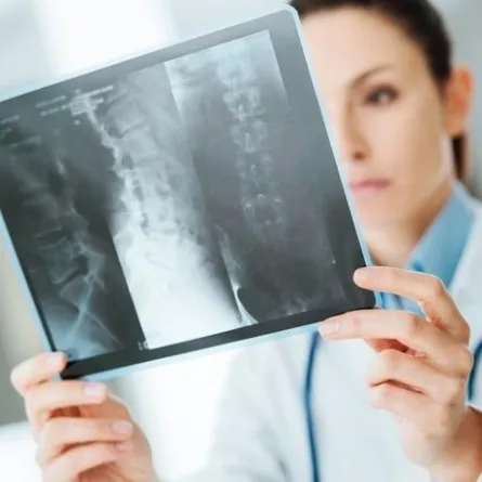 أعراض سرطان العظام عند النساء