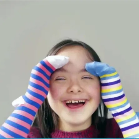 متلازمة داون 