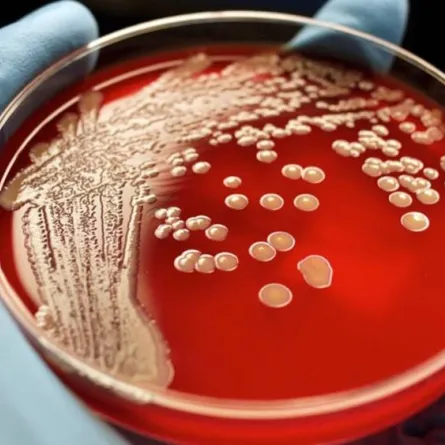 اكتشاف أكبر بكتيريا في العالم تُرى بالعين المجردة