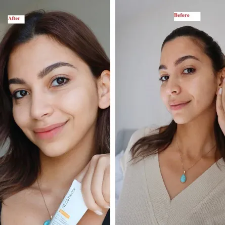 دانا قبل وبعد استخدام المنتجات 