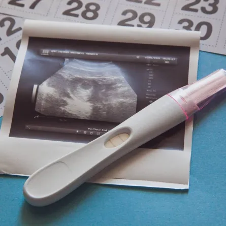 صورة لحمل حديث