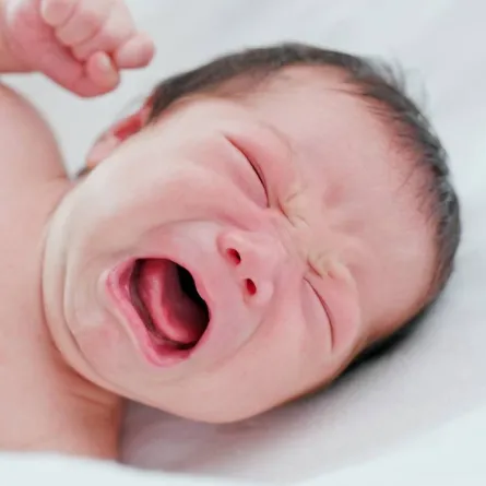 صورة لرضيع يعاني من نوبة بكاء