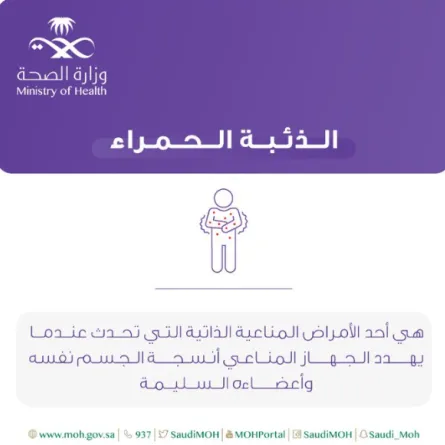 الصحة السعودية تستعرض معلومات عن الذئبة الحمراء - الصورة من حساب الصحة السعودية