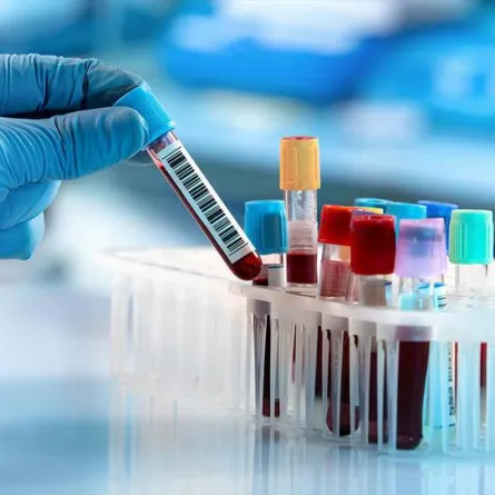 فحوص أساسية لإجرائها قبل الزواج وقبل الحمل خصوصاً