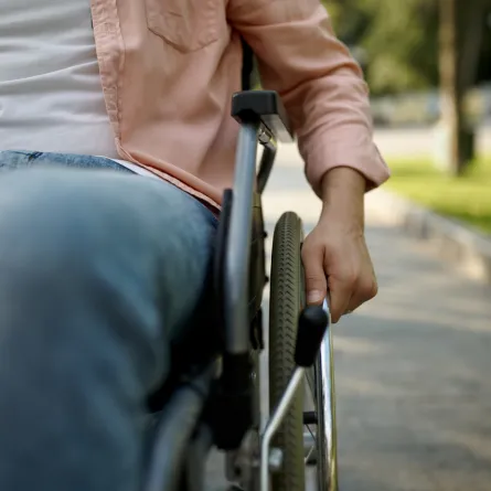 صورة لآثار إصابات الدماغ الرضية