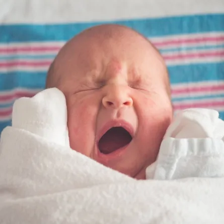 صورة لطفل رضيع يعاني من حساسية بالوجه