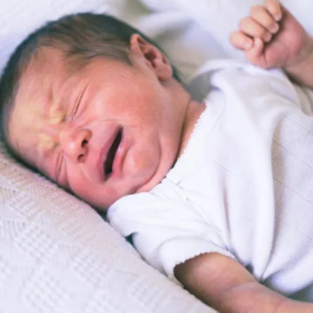 صورة لمولود يتألم بسبب الفتق السري