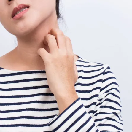 علاج الحساسية والحكة