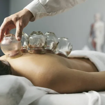 فوائد الحجامة للرجال