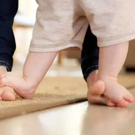 تقوس ساقي الطفل قد يستمر حتى عمر الثالثة