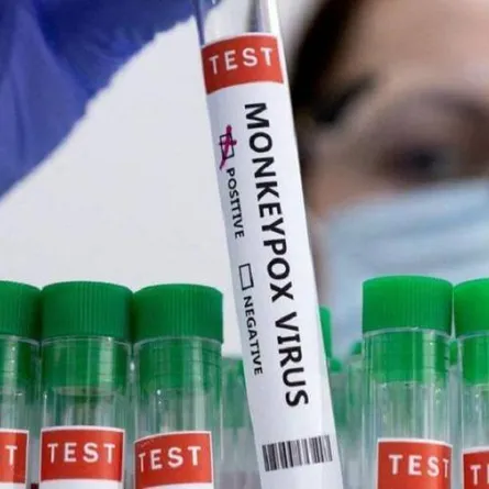 جدري القرود - الصورة من dw