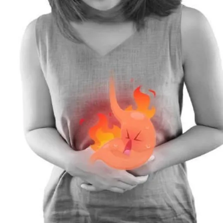 علاج الحرقان الصدري في المنزل