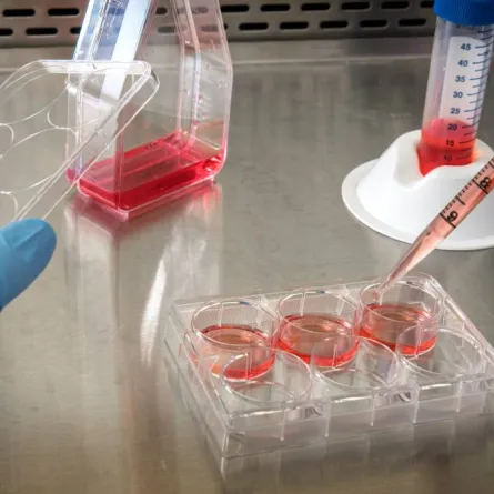  لا يوجد علاج لمرض فيروس ماربورغ